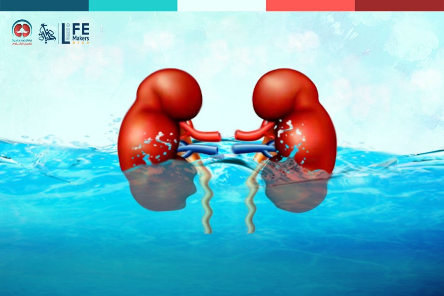 The effect of excess water on patients with renal failure